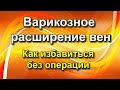 Варикозное расширение вен - Как избавиться без операции - В описании важная инфа.