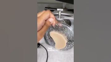 How We Make In-House Retainers at the Ortho Studio!