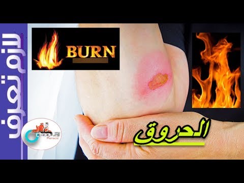  الحروق الاسعافات الأولية درجات الحروق واشكالها لازم تعرف كل ثلاثاء