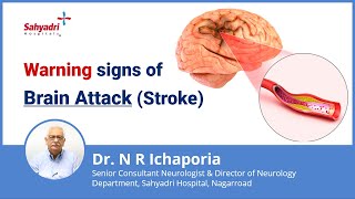 Warning signs of Stroke  | Brain Stroke: SymptomsTreatment & Prevention | Dr. N R Ichaporia