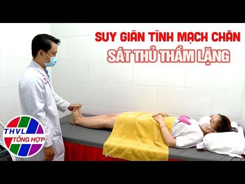 Video: Mang thai Y tế A-Z: Giãn tĩnh mạch