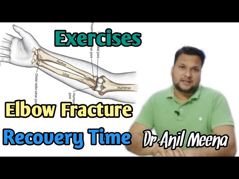 Elbow Fracture Recovery Time | Elbow Fracture Recovery Exercises | Elbow Fracture Exercise |In