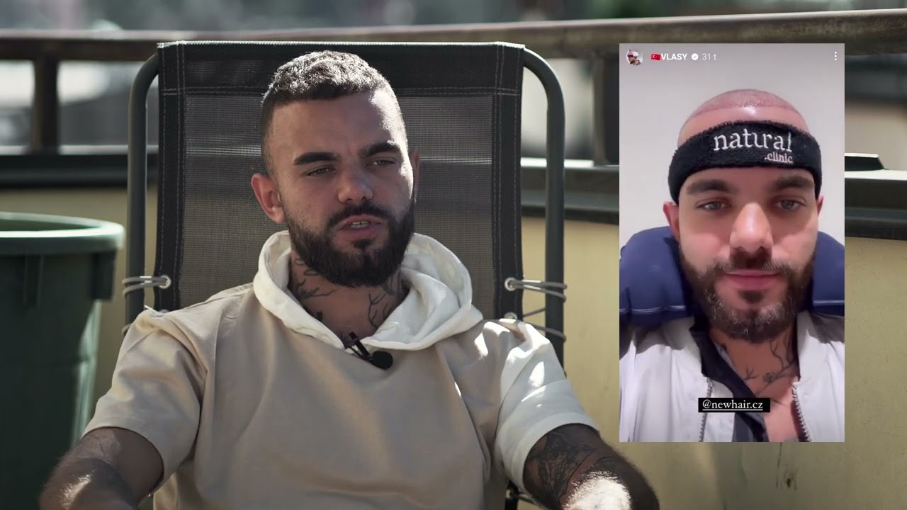 Freescoot odpovídá na nejčastější dotazy k transplantaci vlasů | NewHair.cz