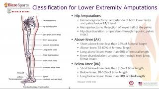 A Deeper Dive into Adaptive Sports Recreation People Living with Limb Loss or Limb
