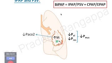 Current Practice of NIV  |  Dr. Pradeep Rangappa