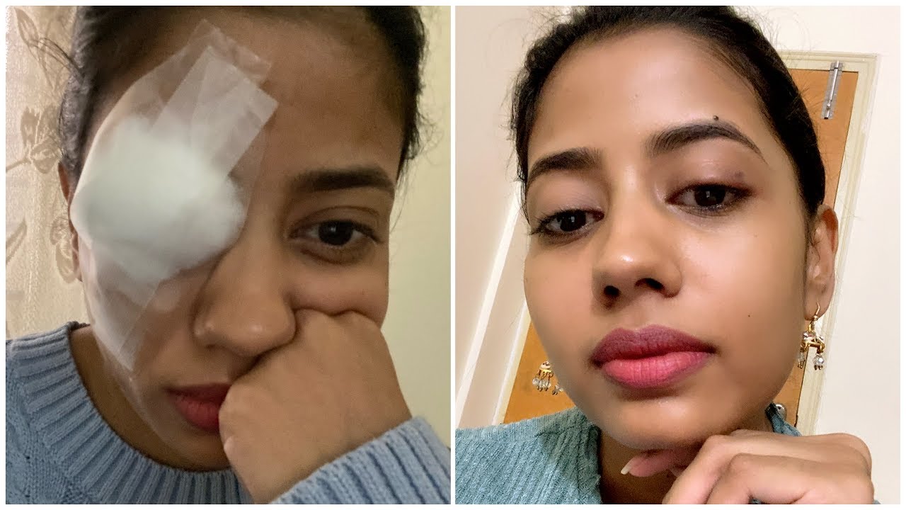 How I Took care of my Skin after Surgery in 3 simple steps YouTube