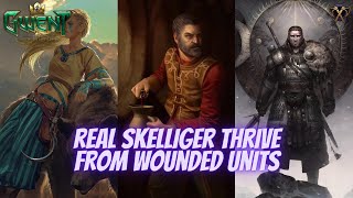 GWENT | Skellige Thrive From Wounded Units | Your Pain Is My Benefit