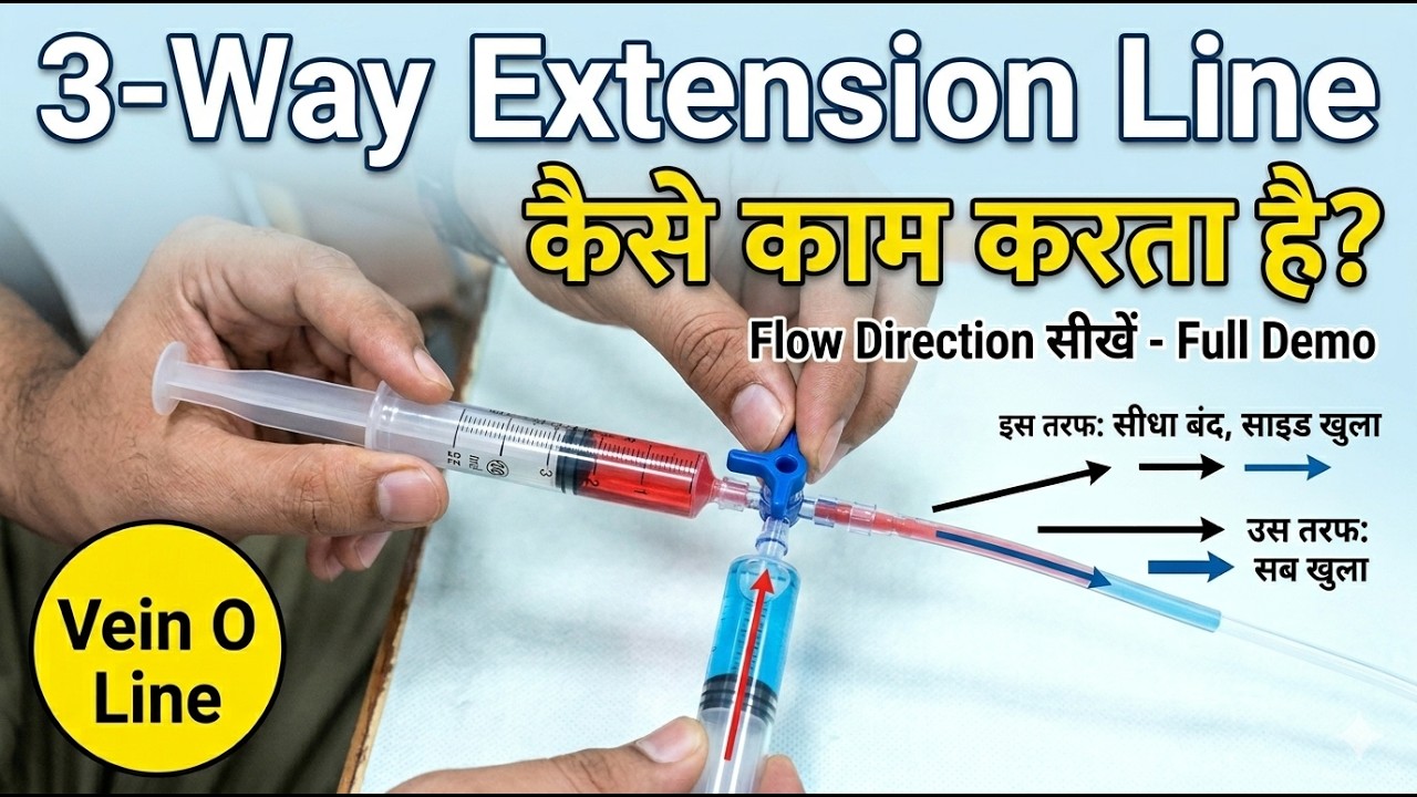 Oreo Line Extensions 3 Way Extension Line / Vein O Line: पूरी जानकारी | Flow Direction and ...
