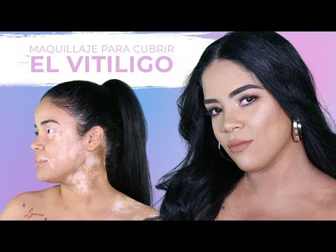 Video: 3 formas de cubrir los parches de vitiligo con maquillaje