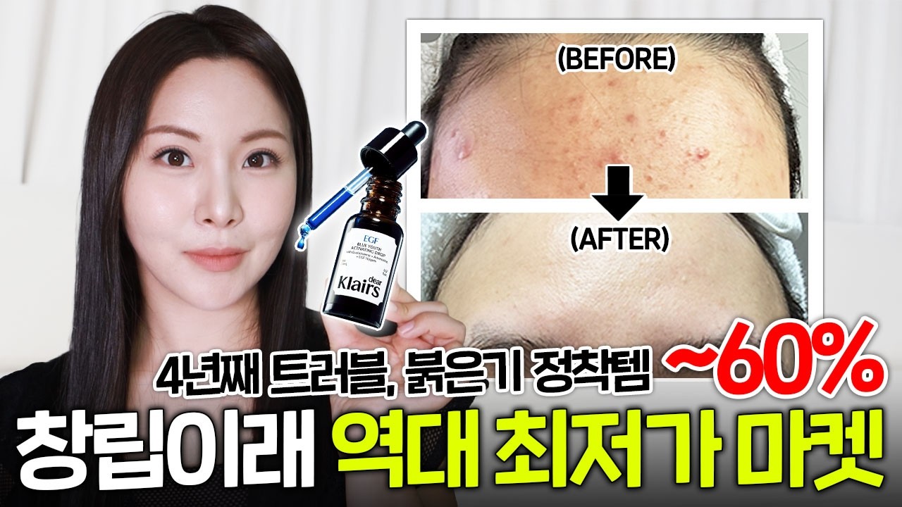 블루드롭 드디어 왔다...💙대체불가 트러블, 붉은기 인생템 🚨창.립.이.래🚨 역대 최저가 마켓 OPEN