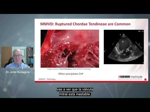 Un seminario web de cardiología
