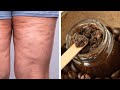 Get Rid of Cellulite and Stretch Marks with this Homemade Coffee Body Scrub!