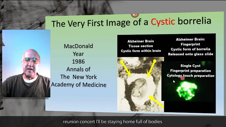 Non Spiralforms of Borrelia Introduction Part i