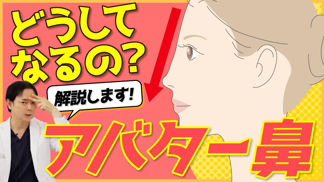 【解説】アバター鼻って何？原因は？