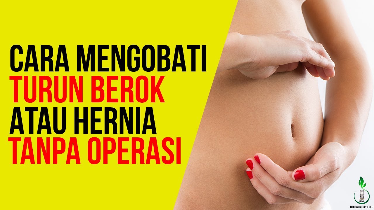 Cara Mengobati Hernia atau Turun Berok
