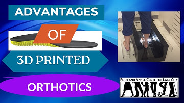 The Advantages of 3D Printed Orthotics