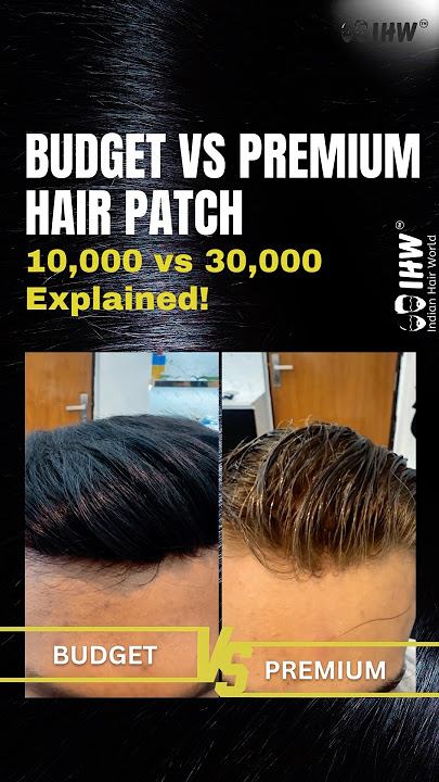 Download lagu Difference between 10,000 & 30,000 hair patch quality #patch #wig #wiginstall #kolkata #hairloss