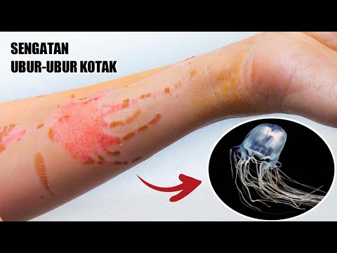 Sengatan Ubur ubur Kotak Paling Mematikan di Dunia