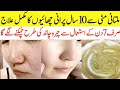 Multani Mitti Face Pack For Every Skin Type | How to Remove Acne And Pigmentation