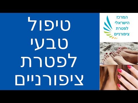 פטרת ציפורניים ברגליים טיפול טבעי