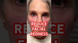 Reduce Facial FLUSHING & REDNESS In 5 Minutes #skincare #over50