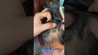 Part 113 Scalp Care Lice Awareness Educational Relaxing Hair Session