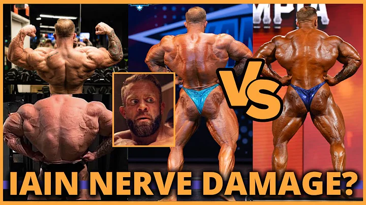 Iain Valliere Lower Lat Nerve Damage? Iain Respond...