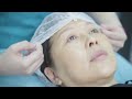 Thread Lift | Dermal Filler | Anti-aging Clinic