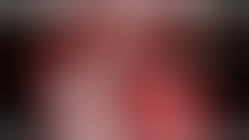 Neurosurgery Super Sunday May 19, 2019: "Clinoidectomy": Iype Cherian MD