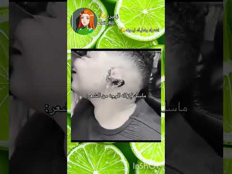 ٱخر شي عينه طلعت اشهد ان عليا ولي الله اللهم صل على محمد وال محمد 