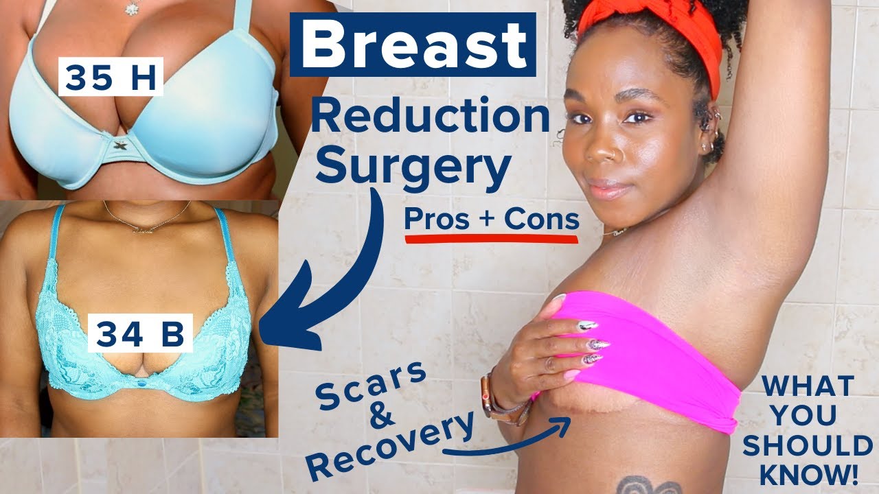 Breast Lift Before And After Scars