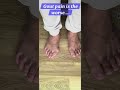 gout pain is the worse..#gout #asian #shorts #fyp