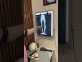 Chiropractic varun duggal is live  bow legs treatment by dr varun duggal mumbai shortfeed