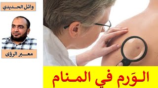 انتبه !!! من حلم الورم في المنام / الورم في الحلم / وائل الحديدي