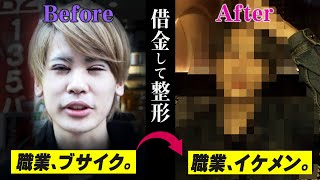 ブサイクと呼ばれたホストが整形手術！1000万プレーヤー並みのイケメンに大変身！！【Club AIR】