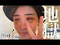 【整形】やっぴ、がんばりました💮