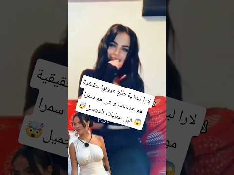 لارا اللبنانية قبل عمليات التجميل قسمة ونصيب فرصة ثانية قسمة ونصيب   
