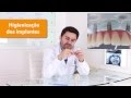 Como Higienizar os Implantes Dentários (3 Técnicas de Higienização)