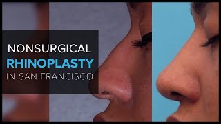 Non Surgical Rhinoplasty ("Liquid Nose Job") With Dermal Fillers at Mabrie Facial Institute