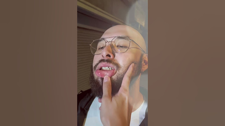 男孩子出門在外要懂得保護自己😔