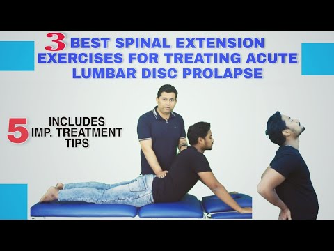 BEST WAY TO PERFORM SPINAL EXTENSION EXERCISES IN ACUTE LUMBAR PIVD(Sciatica)