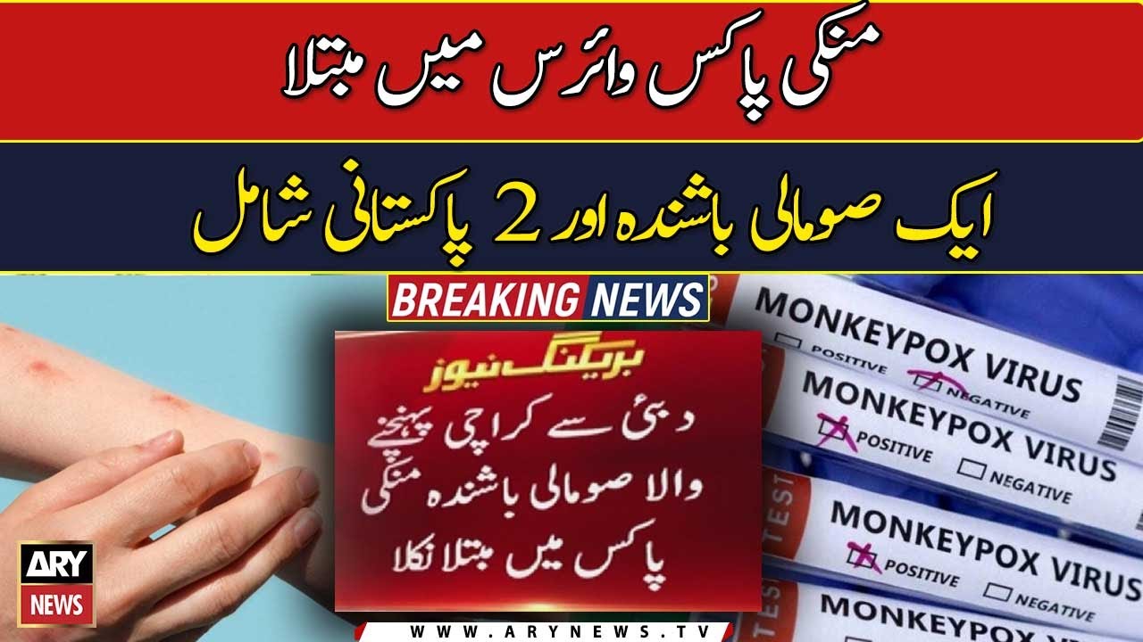 Three monkeypox cases detected in Karachi