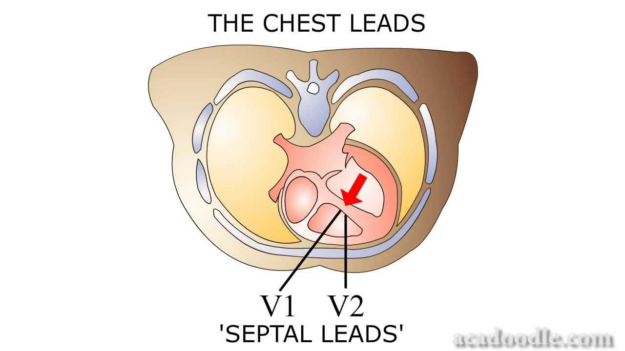 Ecg Interpretation - Ecg Lead Perspectives