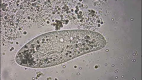Paramecium under the microscope