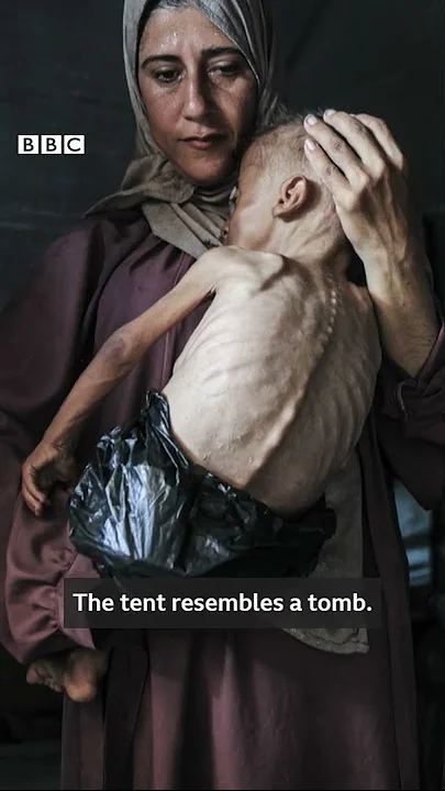 Gaza: ‘This photo is to show babies and children are facing hunger’ – BBC Africa