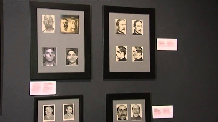 Pr Bernard Devauchelle : Expo les gueules cassées
