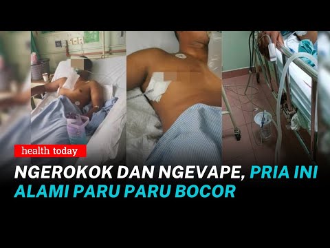 Video: Apa yang terjadi selama SCNT?