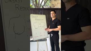 Breast Reduction Basics
