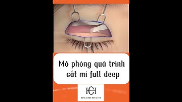 Mô phỏng quá trình cắt mí full deep | Hacchic Beauty