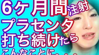 【元男子激白】半年間プラセンタ注射を打ち続けて体に起きた異変を告白。。。